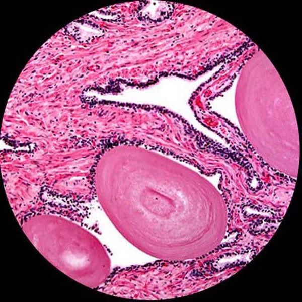 Trinocular Biological Compound Microscope with Plan Objectives and 14MP USB Digital Camera B554